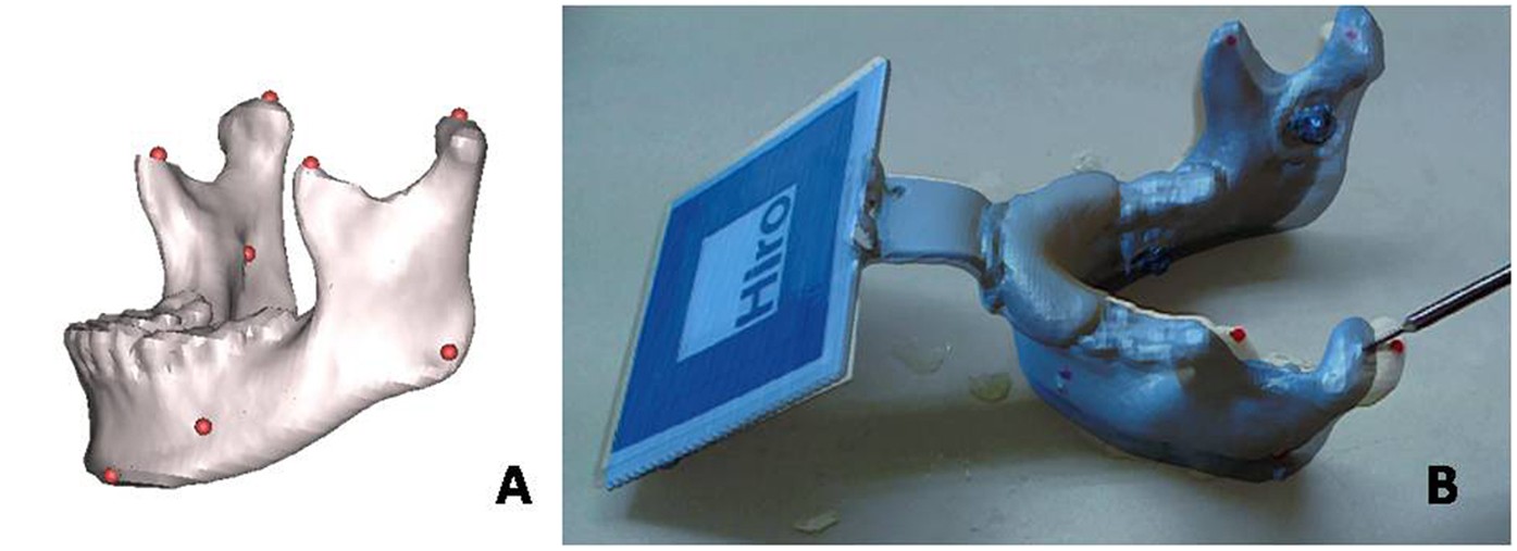 Figure 6: Eleven points marked in red on both 3D virtual mandible and the printed real models.
