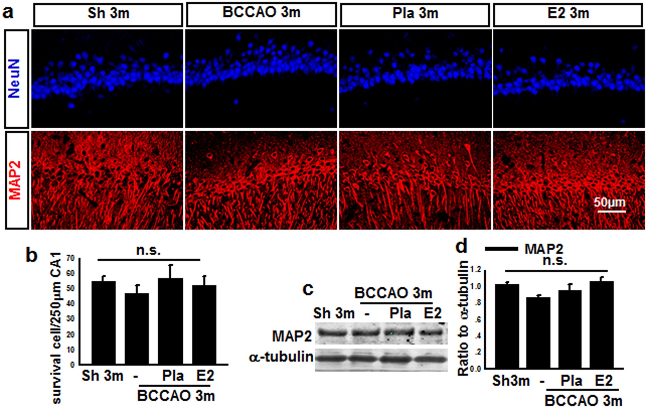 Figure 2: Effects of E2-treatment upon neuronal markers (NeuN, MAP2) in hippocampal CA1 region at 3 months after BCCAO.