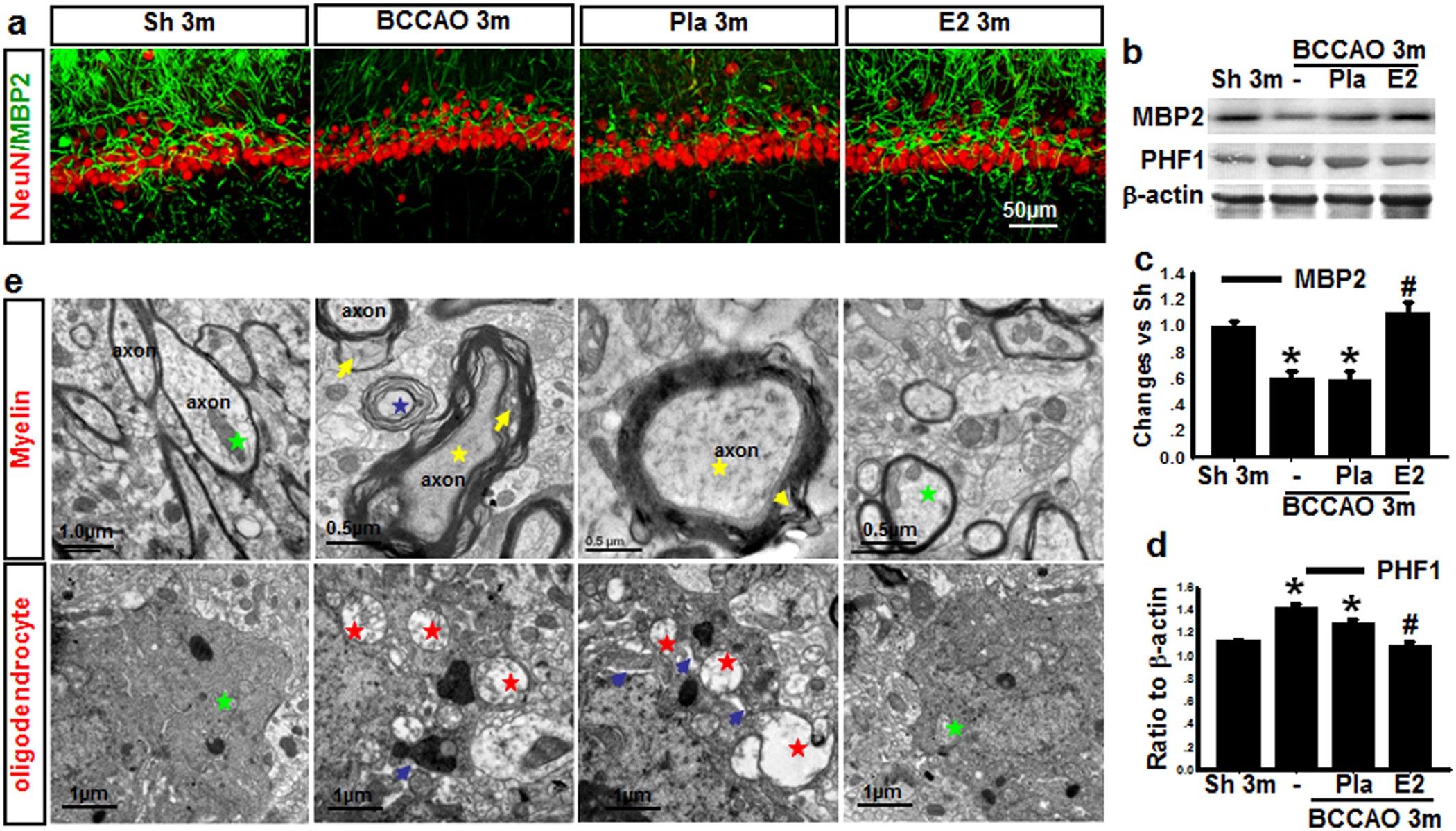 Figure 3: Effects of E2-treatment upon the ultrastructure of axons, myelin, oligodendrocytes, and expression of axonal proteins in the hippocampal CA1 region after chronic BCCAO.
