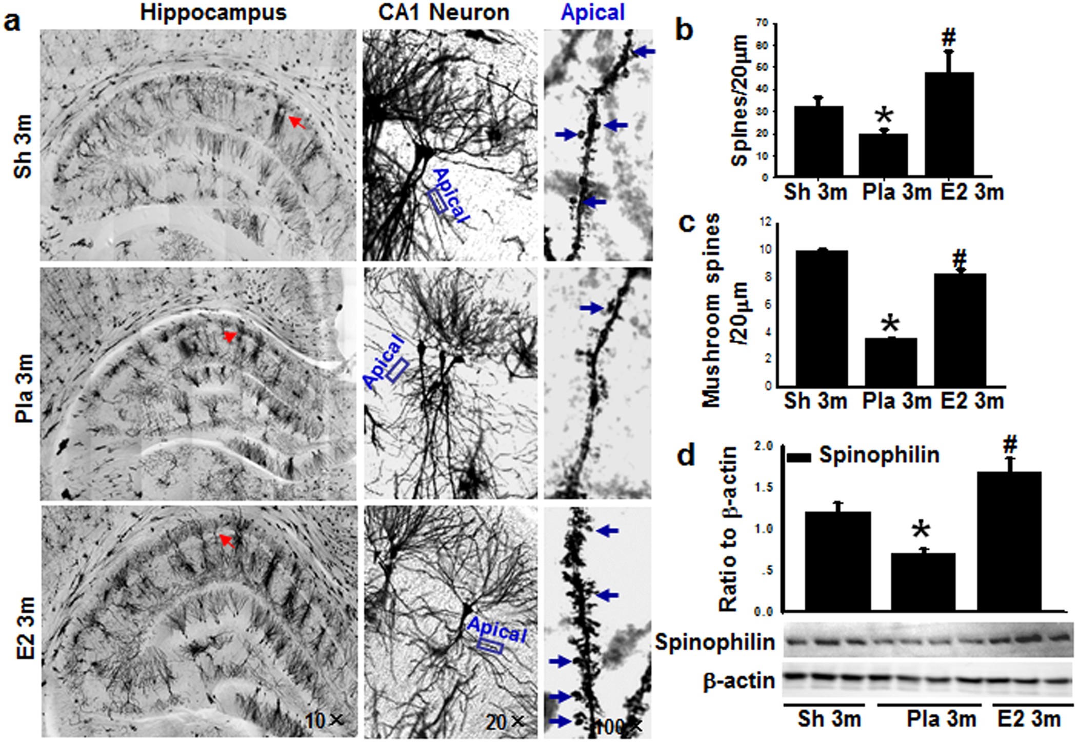 Figure 4: Micrograph of Golgi staining shows apical dendrites from hippocampal CA1 pyramidal neurons.