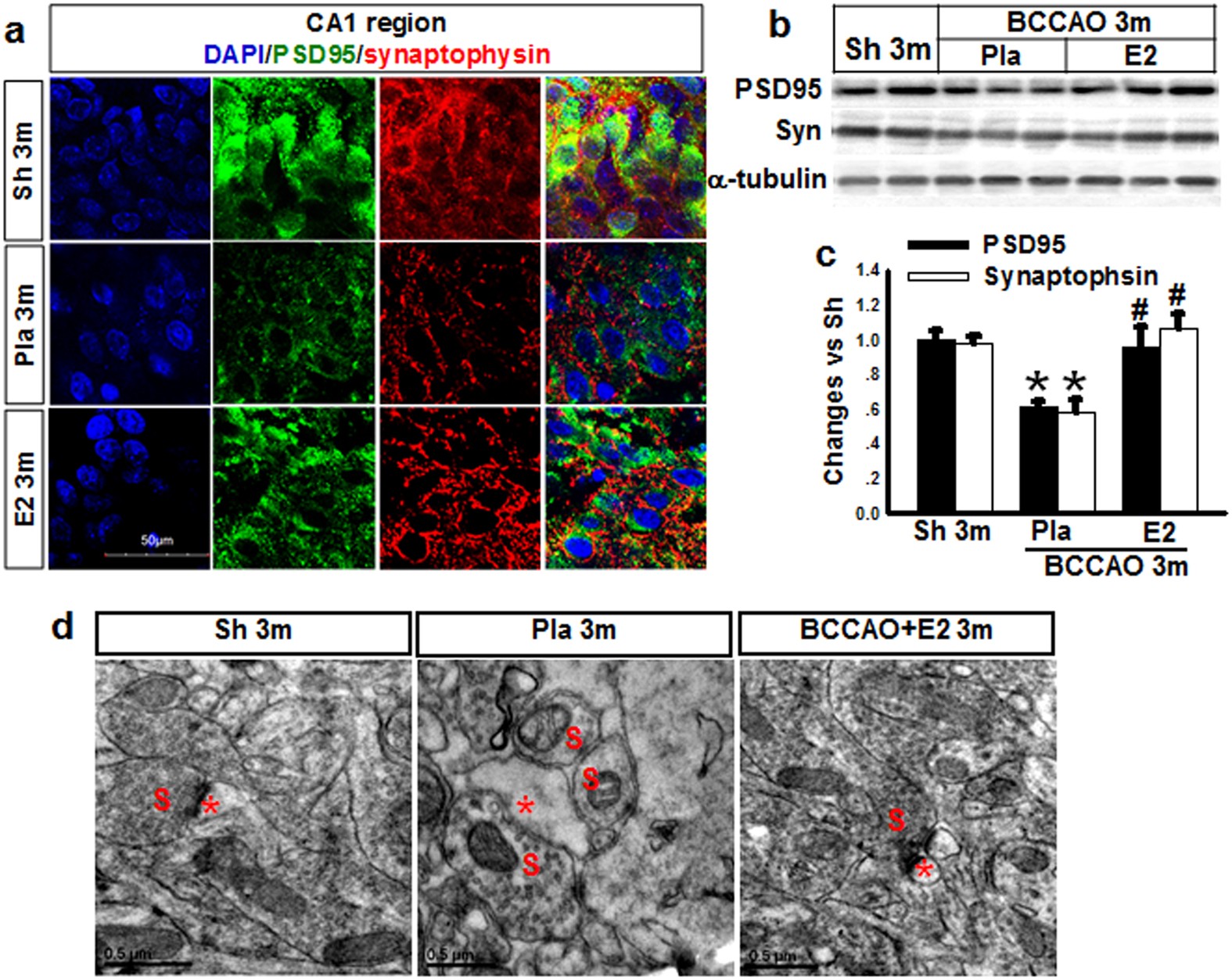 Figure 5: Effects of E2 treatment on synaptic markers (PDS95, Synaptophysin) and ultrastructure of synapses of hippocampal CA1 neurons at 3 m after BCCAO.