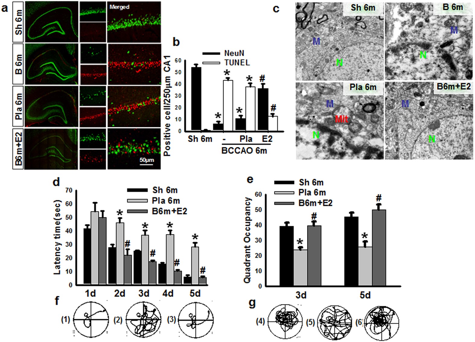 Figure 6: Administration E2 for 3 m decreases CA1 neuronal apoptosis and cognitive impairment after BCCAO 6 m.