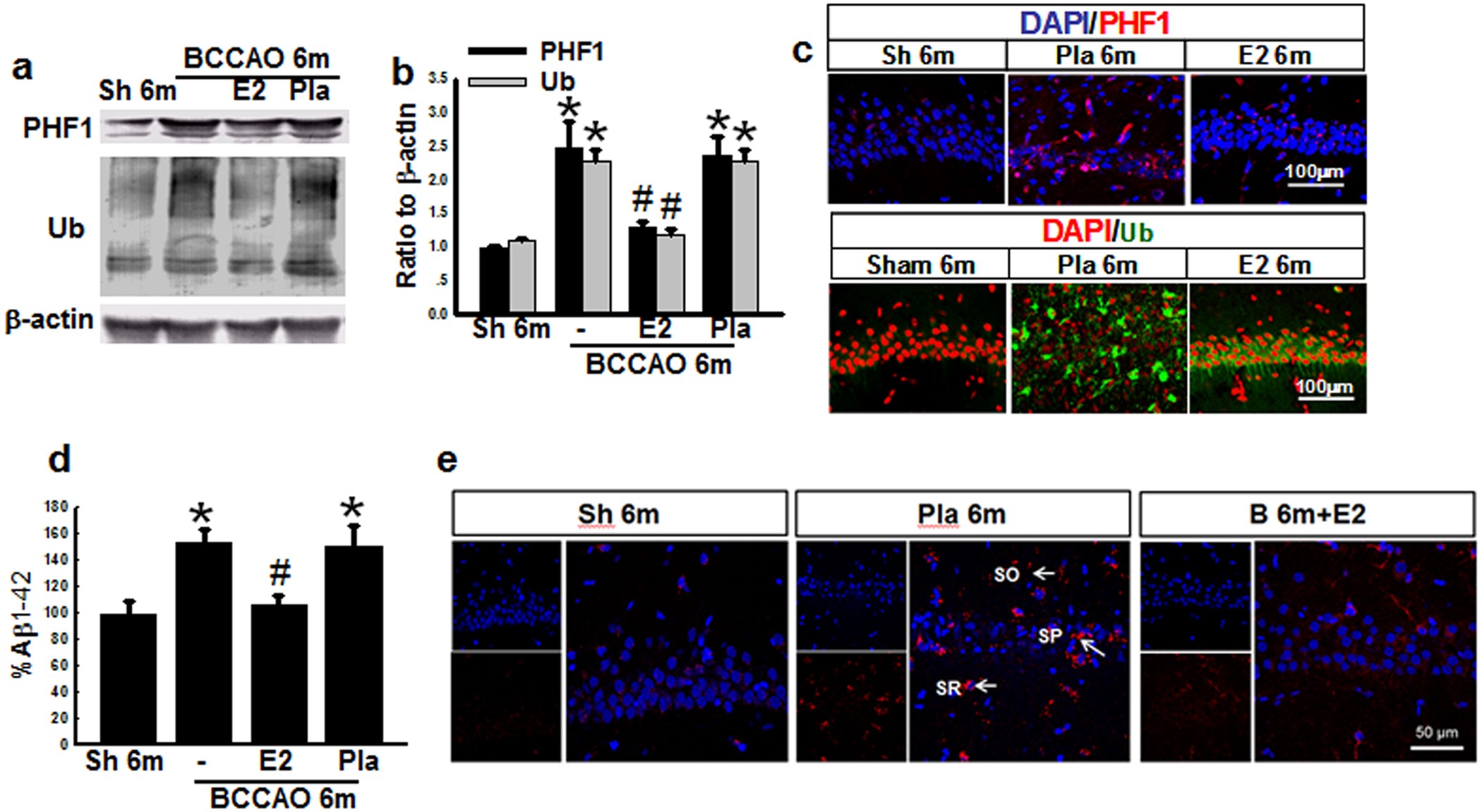 Figure 7: E2-treatment for 3 m decreases the protein expression of dementia biomarkers in hippocampal CA1 region 6 m after BCCAO.