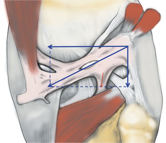 Anatomical Characteristics and Biomechanical Properties of the Oblique  Popliteal Ligament | Scientific Reports