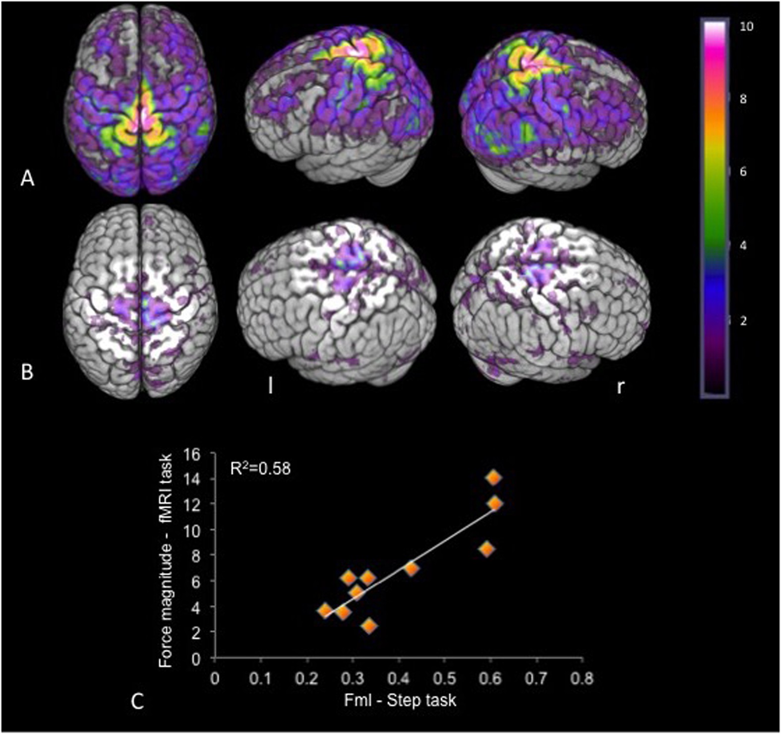 An fMRI-compatible force measurement system for the evaluation of the  neural correlates of step initiation | Scientific Reports