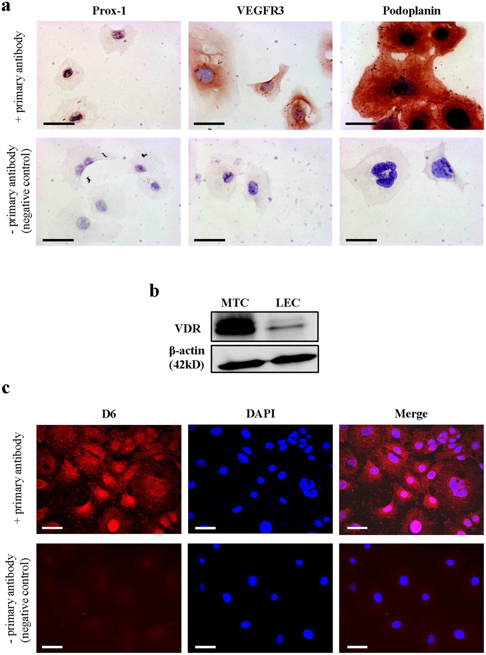 Vitamin D Inhibits Lymphangiogenesis Through Vdr Dependent