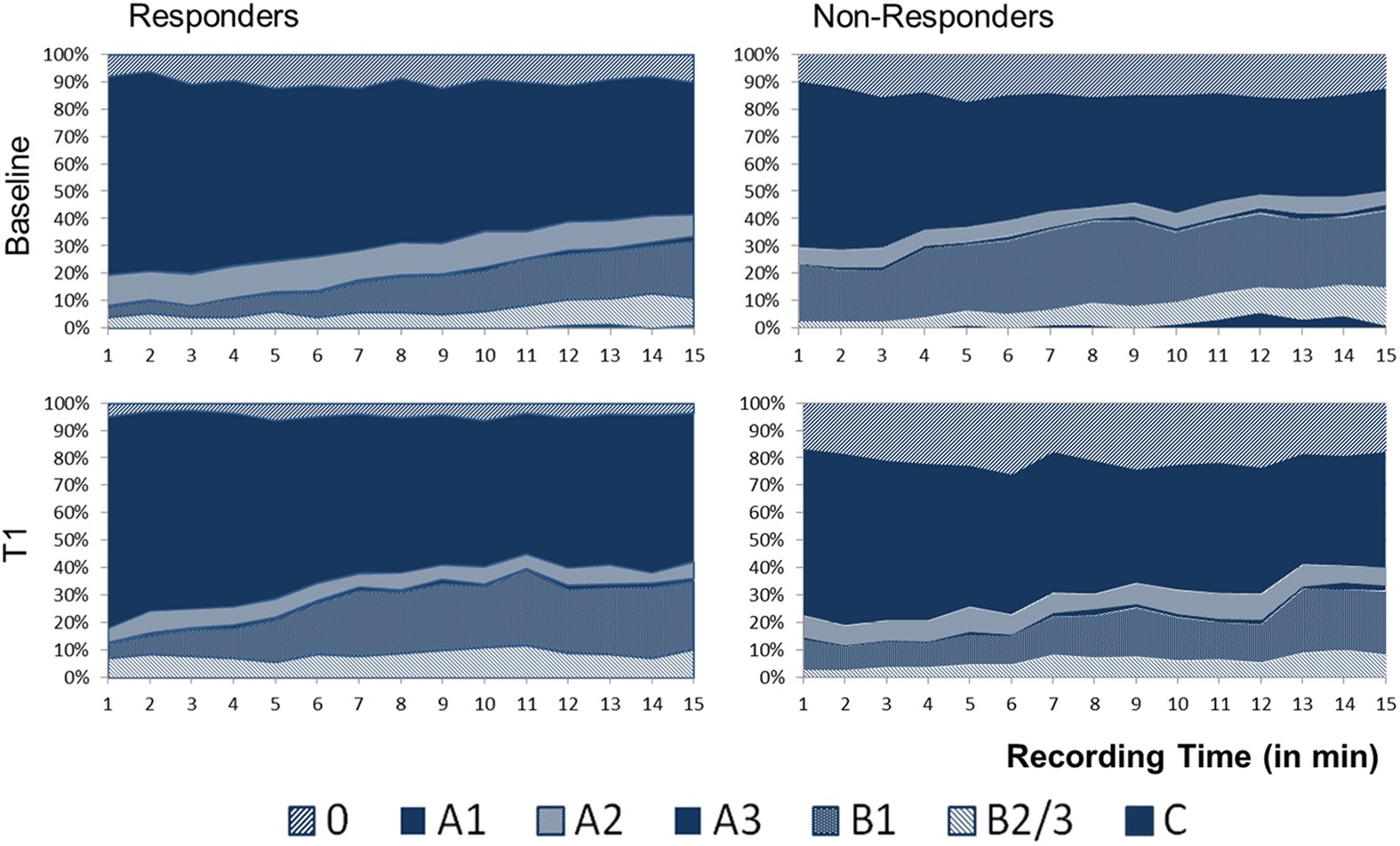 Brain Arousal Regulation As Response Predictor For Antidepressant Therapy In Major Depression Scientific Reports