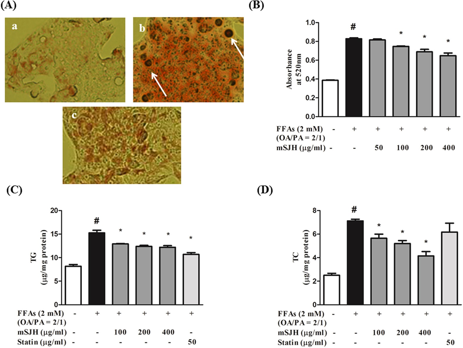 Modified Sjh Alleviates Ffas Induced Hepatic Steatosis Through Leptin Signaling Pathways Scientific Reports Modified Sjh Alleviates Ffas Induced Hepatic Steatosis Through Leptin Signaling Pathways Scientific Reports