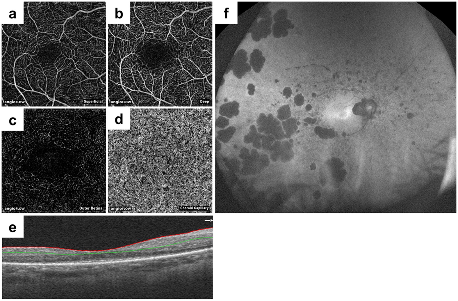 PDF] Multivariate cube integrated retinal variable to visually