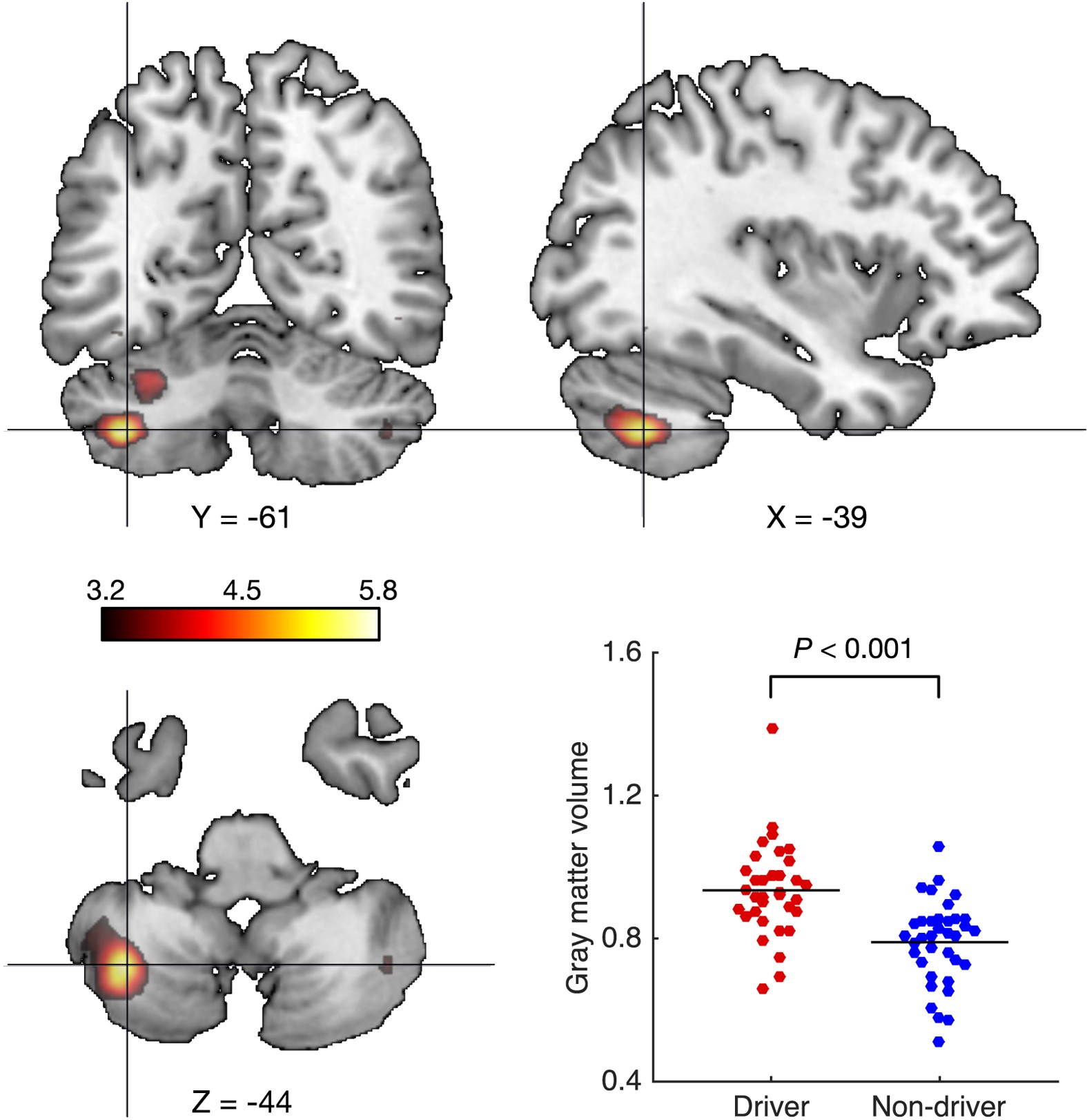 Greater Cerebellar Gray Matter Volume In Car Drivers An Exploratory Voxel Based Morphometry Study Scientific Reports