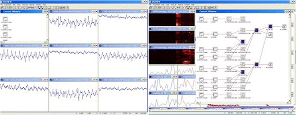 Figure 11