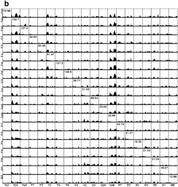 Figure 12