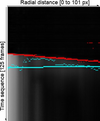 Figure 14