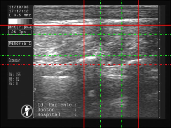 Figure 23