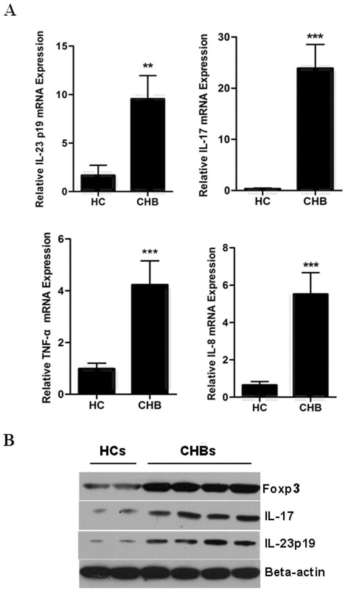 Activated Il 23 Il 17 Pathway Closely Correlates With Increased Foxp3 Expression In Livers Of Chronic Hepatitis B Patients Bmc Immunology Full Text