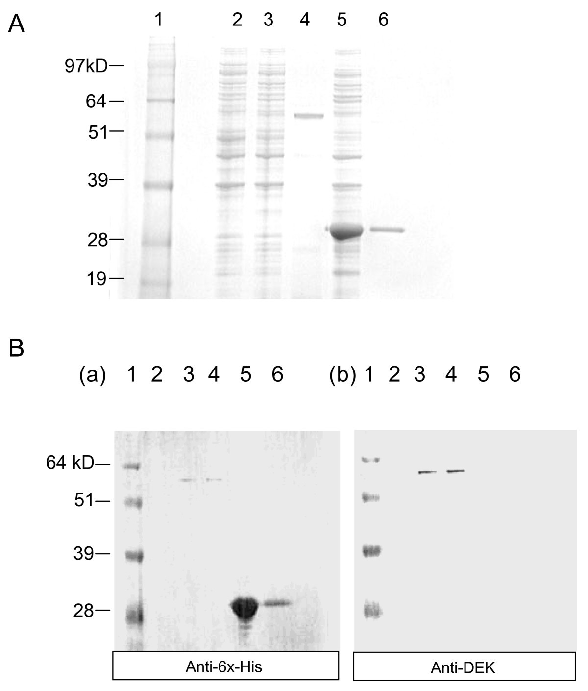 Serum from mice immunized in the context of Treg inhibition identifies DEK  as a neuroblastoma tumor antigen | BMC Immunology | Full Text