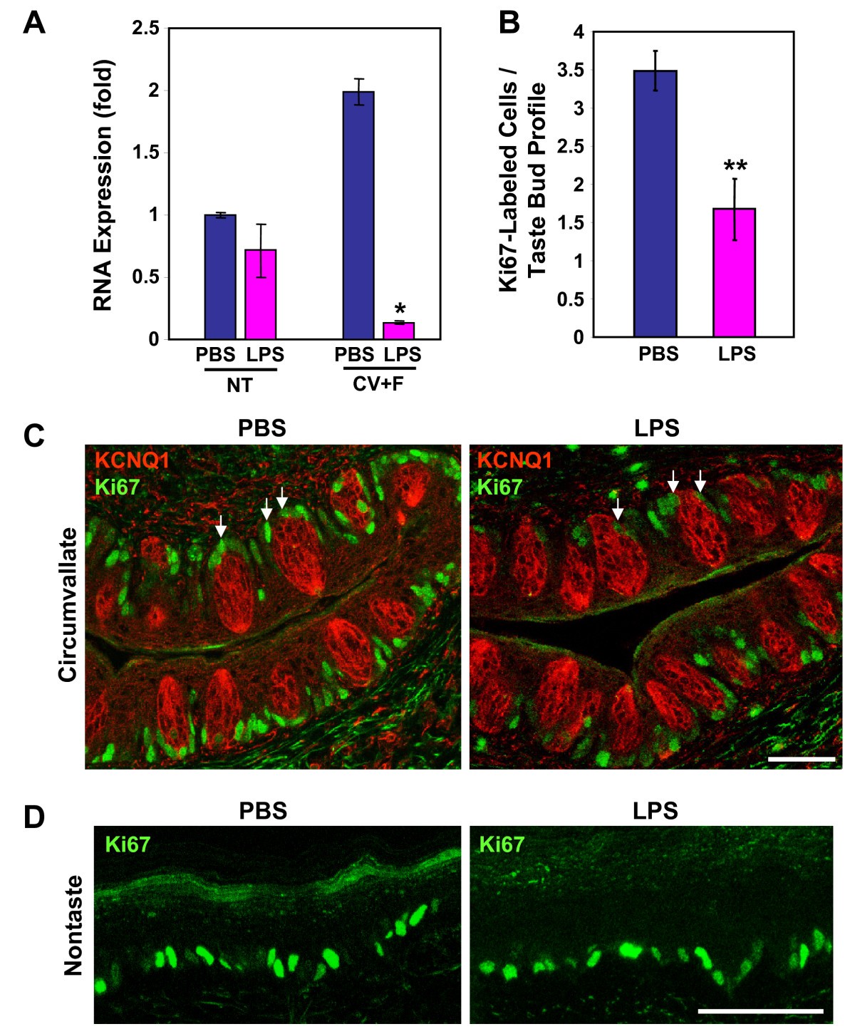 Lipopolysaccharide Induced Inflammation Attenuates Taste Progenitor Cell Proliferation And Shortens The Life Span Of Taste Bud Cells Bmc Neuroscience Full Text