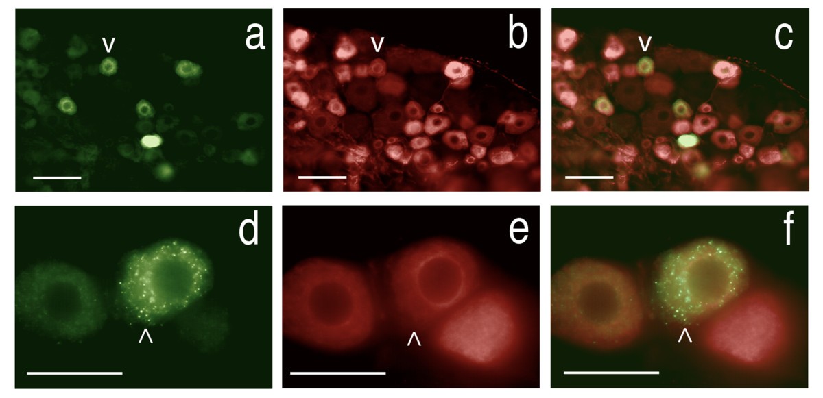 Figure 14