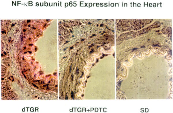 Figure 22