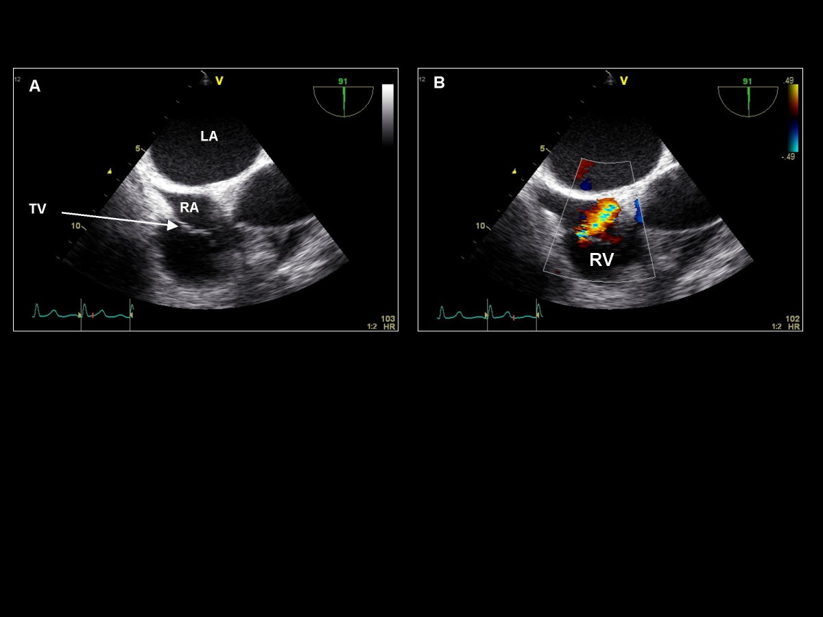 Figure 13