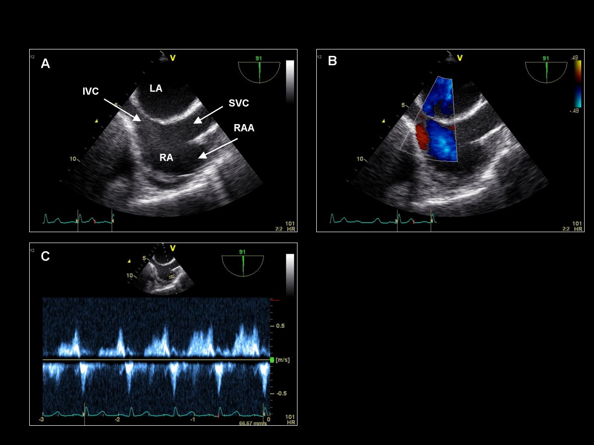 Figure 14