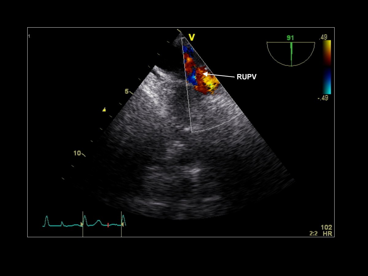 Figure 15