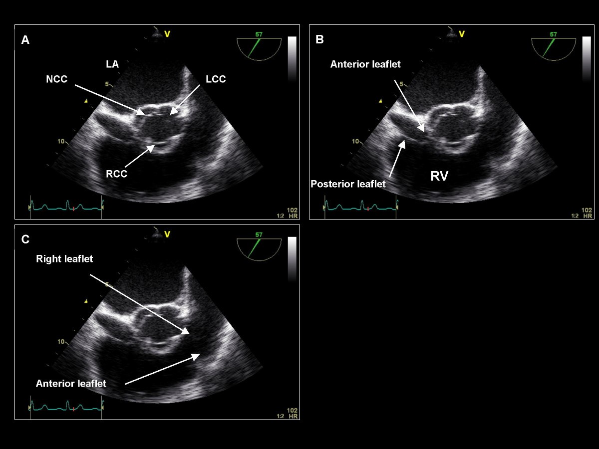 Figure 19