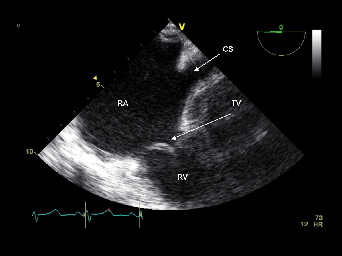 Figure 21