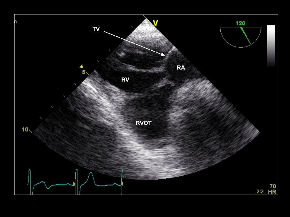 Figure 25