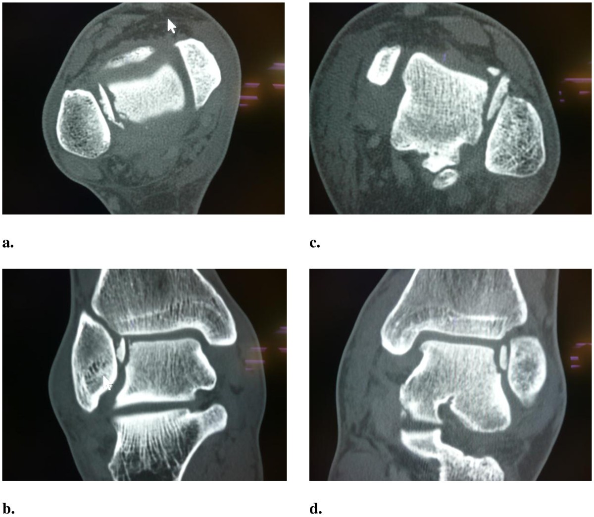 Figure 4