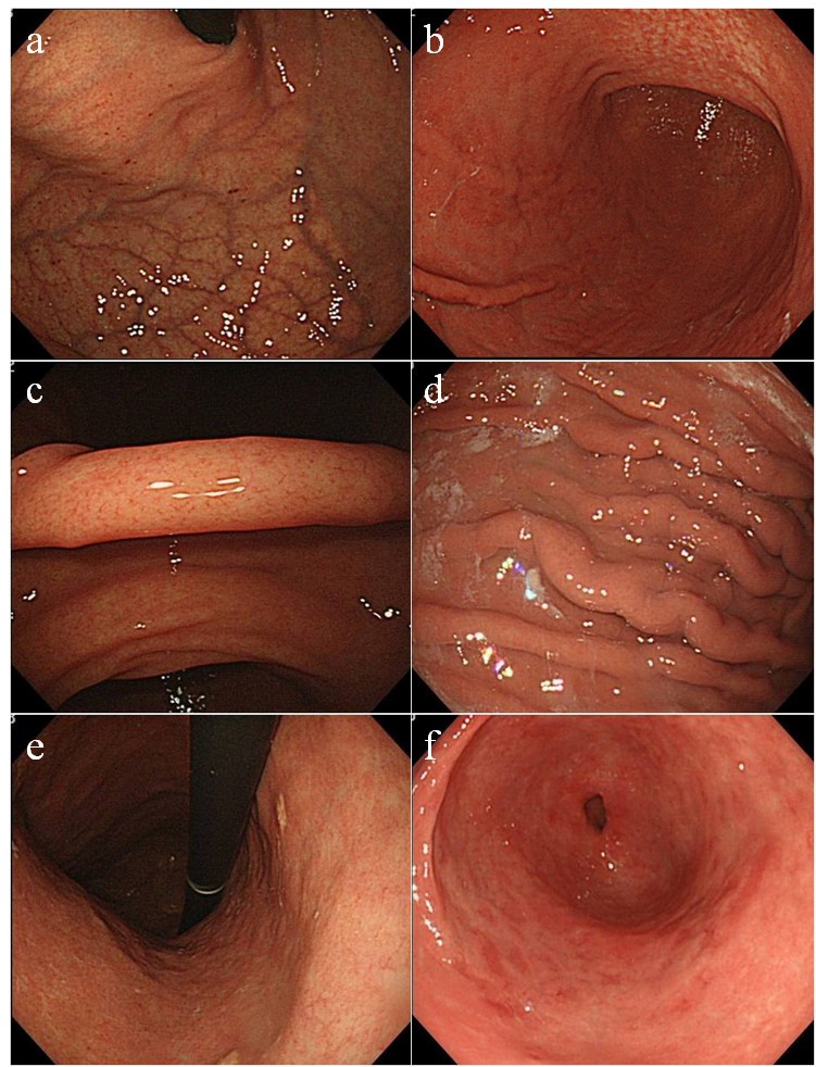 bælte Smuk revidere Accuracy of endoscopic diagnosis of Helicobacter pyloriinfection according  to level of endoscopic experience and the effect of training | BMC  Gastroenterology | Full Text