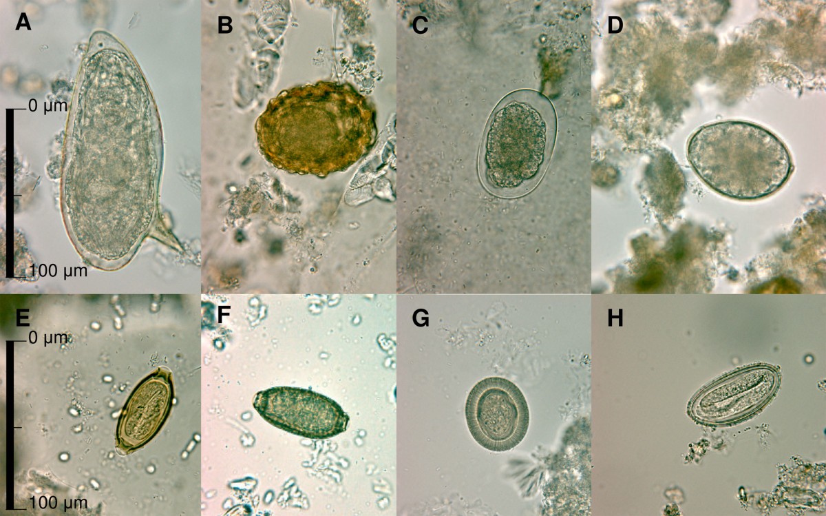 Споры в кале у взрослого. Яйца гельминтов микроскопия. Яйца гельминтов микроскопия атлас. Микроскопия кала яйца гельминтов. Diphyllobothrium latum яйца.