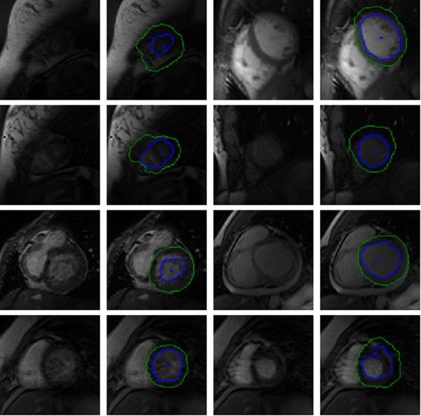 Figure 11