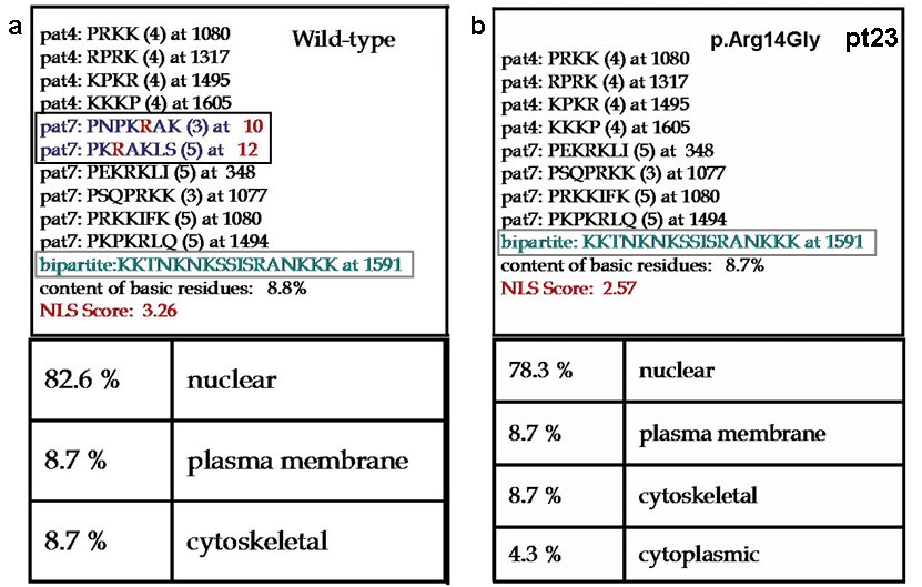 Rubinstein-Taybi Syndrome: spectrum of CREBBP mutations in Italian patients, BMC Medical Genetics