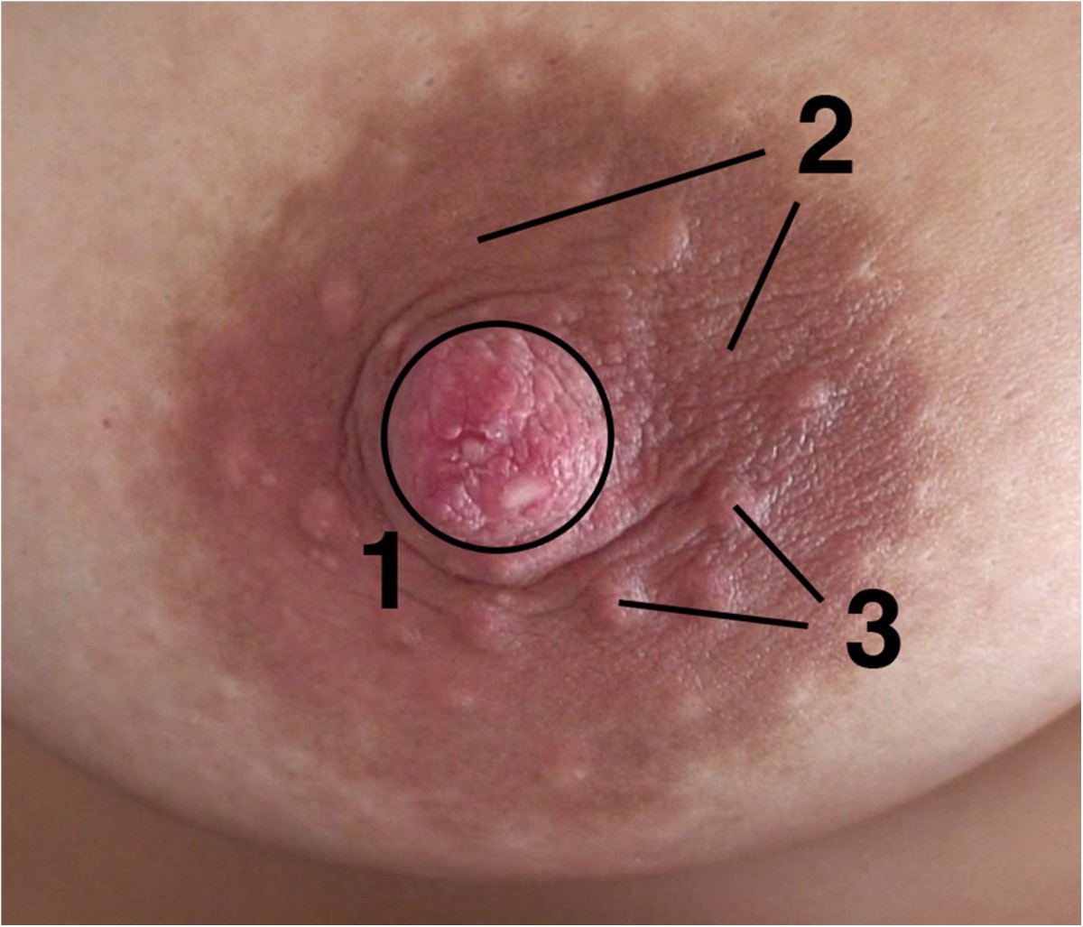 What Your Nipple Could Be Communicating About Your Health