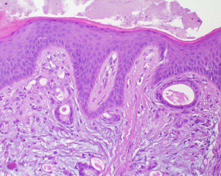 hard palate histology