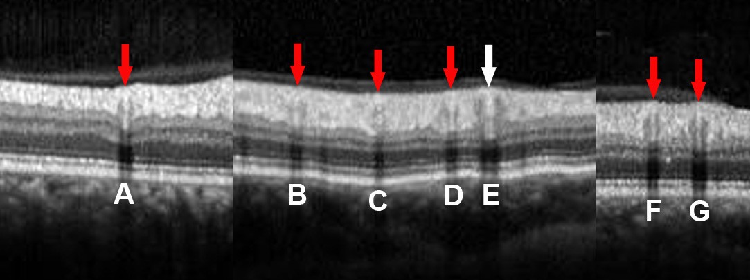 Figure 6