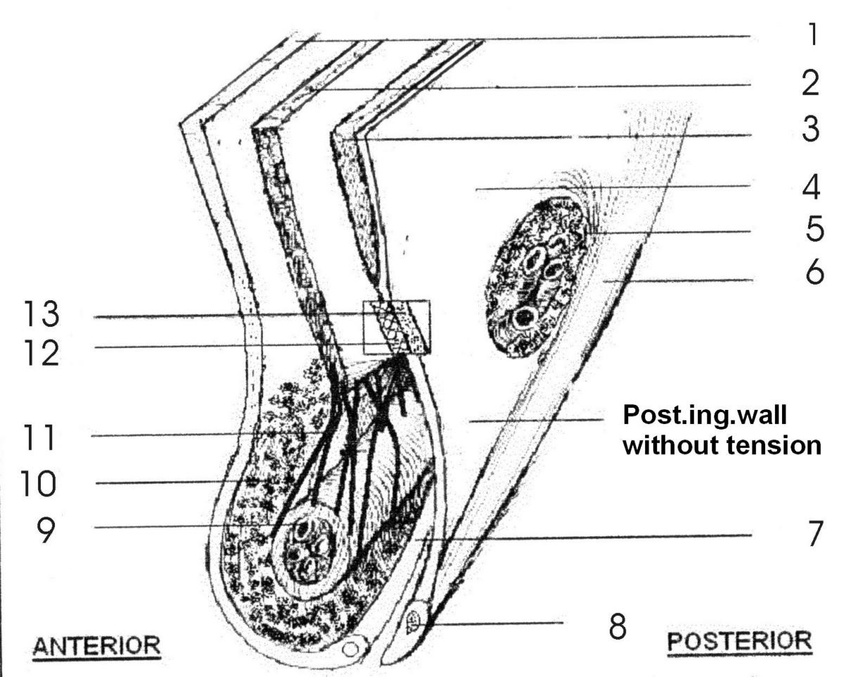 3D Inguinal Canal Anatomy - Boundaries of Inguinal Canal - Superficial and Deep  Inguinal Ring - YouTube