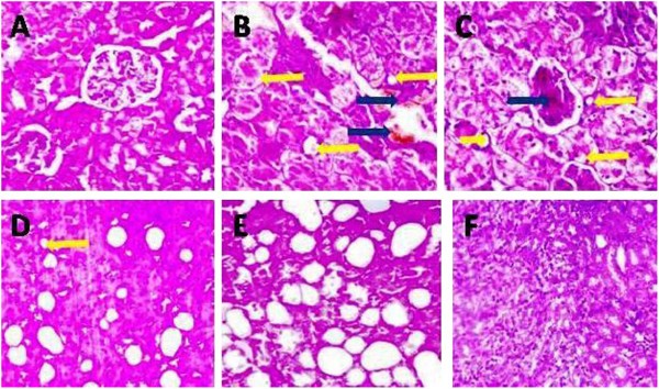 Figure 22