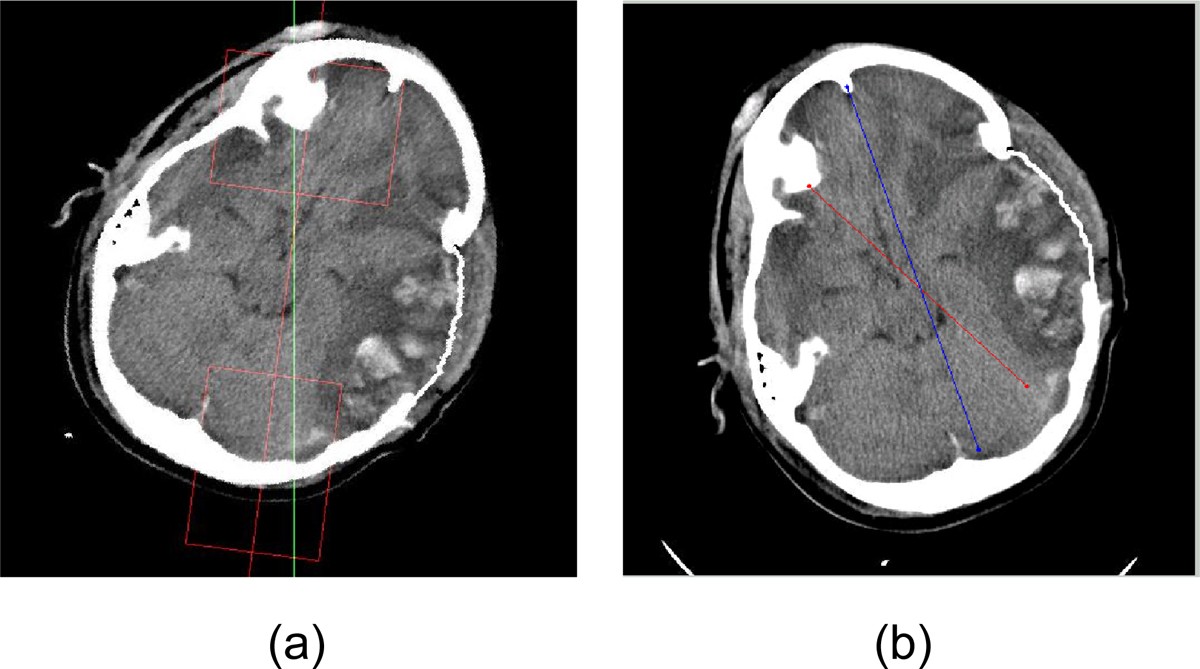 Figure 12