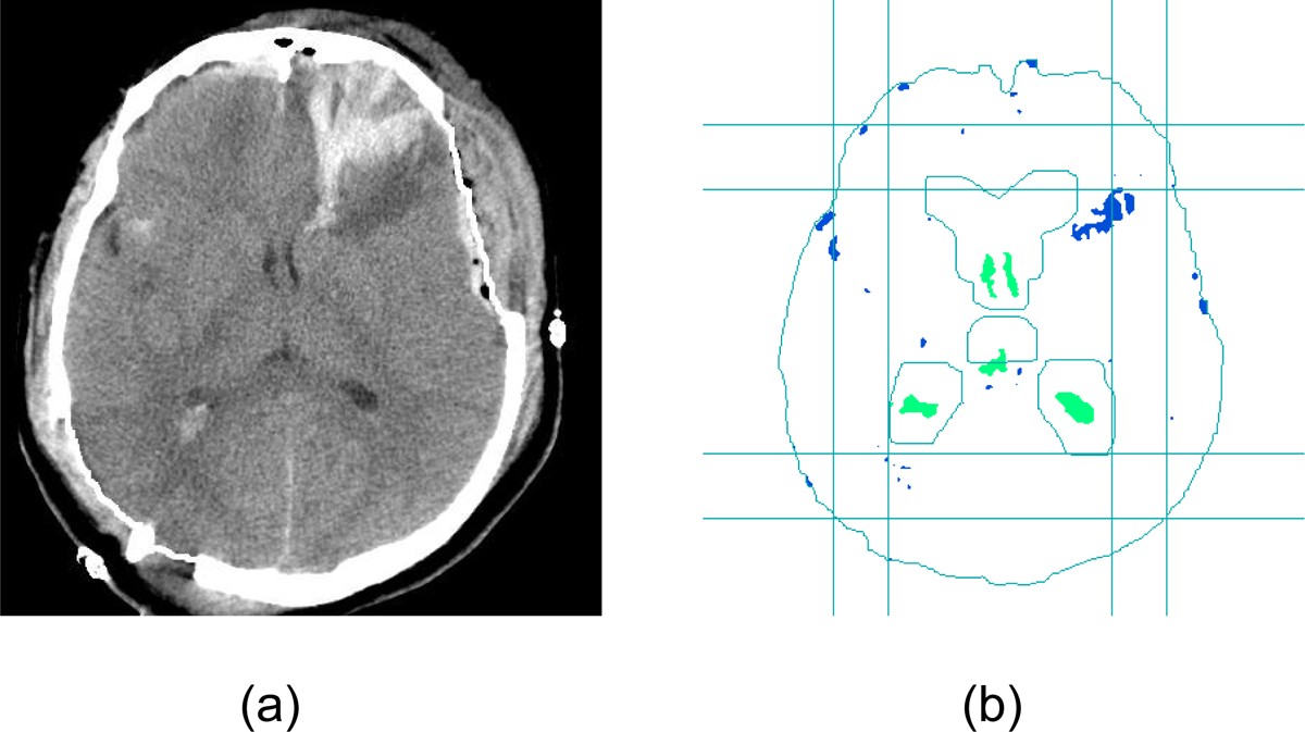 Figure 17