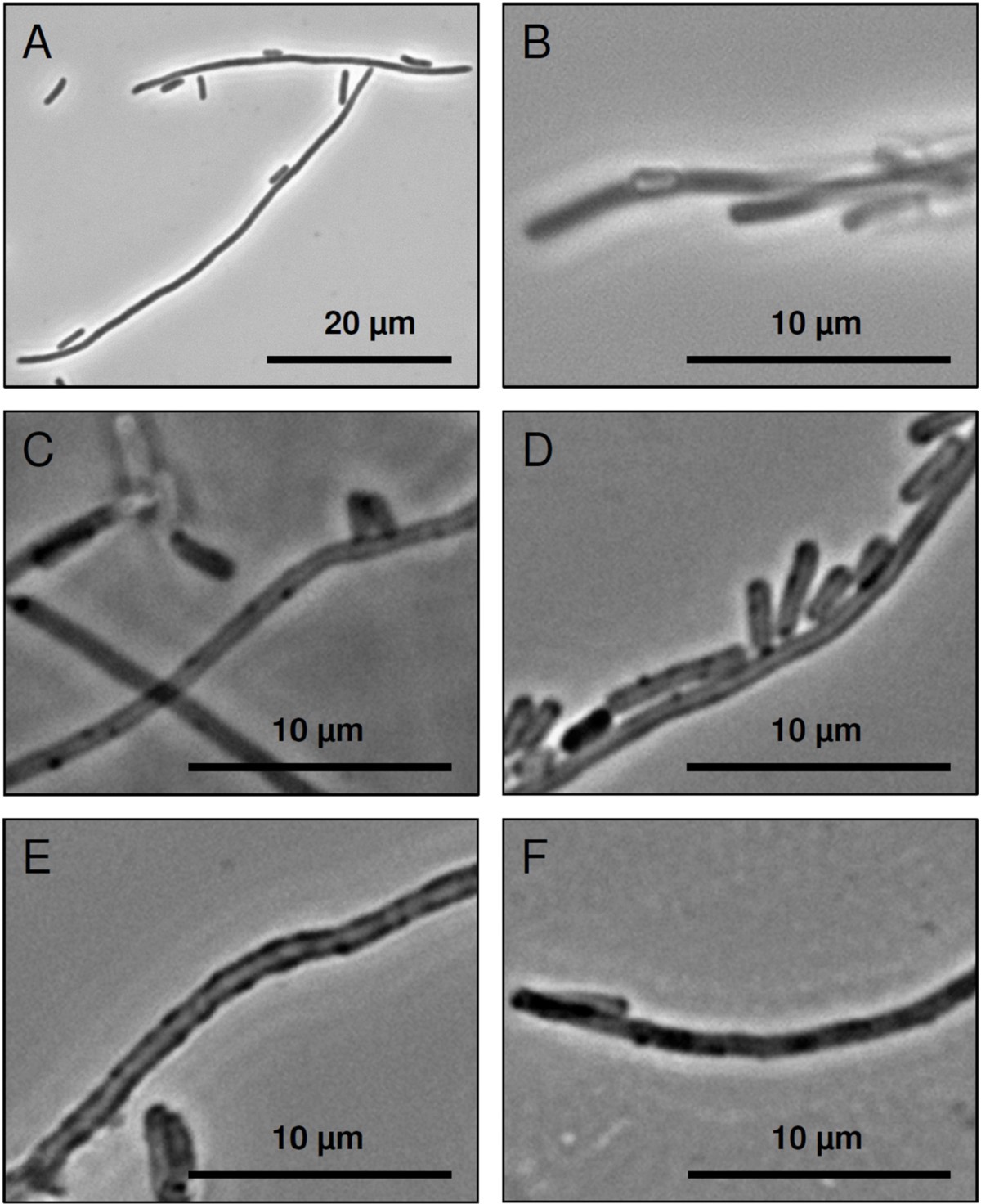 Development Of Functionalised Polyelectrolyte Capsules Using Filamentous Escherichia Coli Cells Microbial Cell Factories Full Text