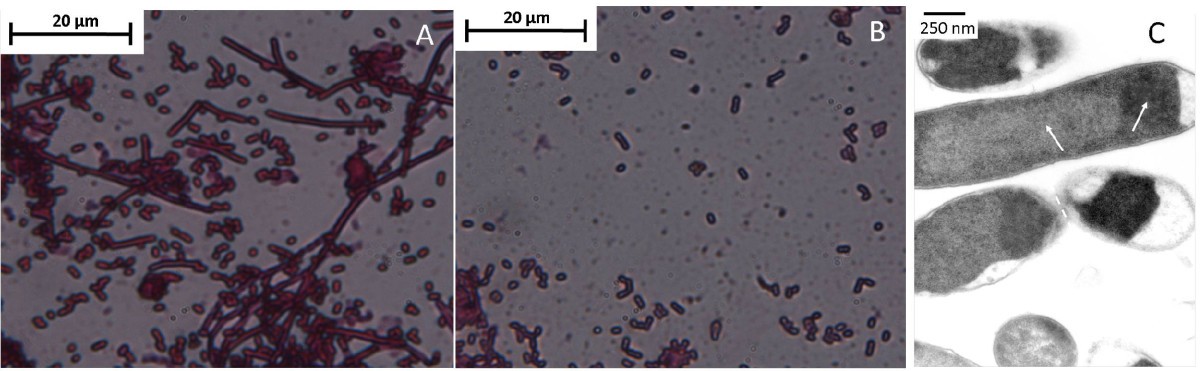 Recombinant Production Of The Therapeutic Peptide Lunasin Microbial Cell Factories Full Text Recombinant Production Of The Therapeutic Peptide Lunasin Microbial Cell Factories Full Text