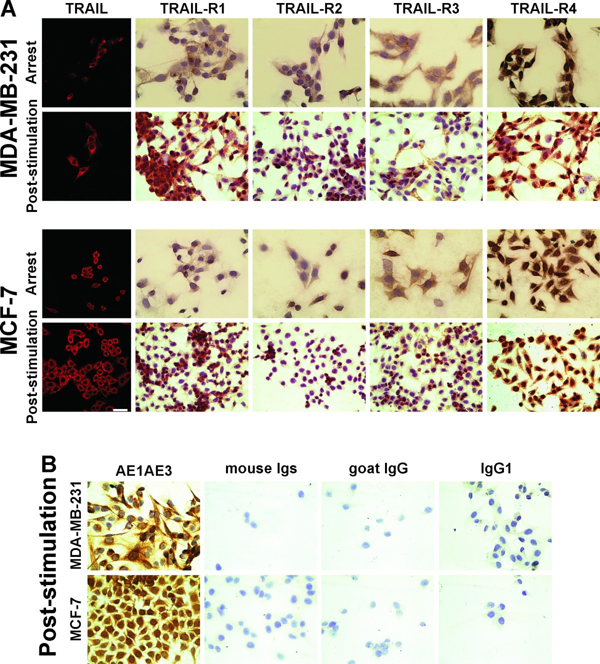Expression of osteoprotegerin, receptor activator of nuclear factor kappa-B  ligand, tumor necrosis factor-related apoptosis-inducing ligand, stromal  cell-derived factor-1 and their receptors in epithelial metastatic breast  cancer cell lines | Cancer ...
