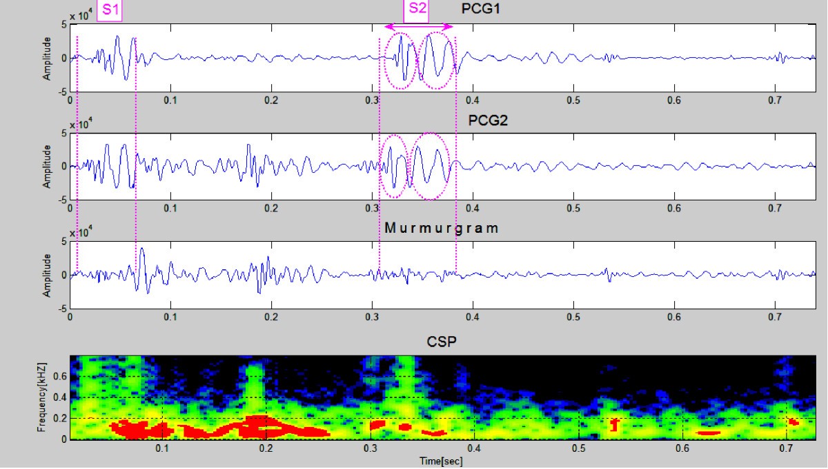 Figure 11