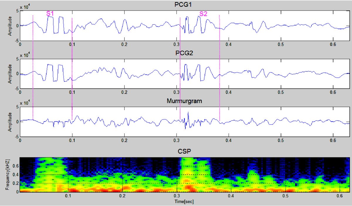 Figure 13