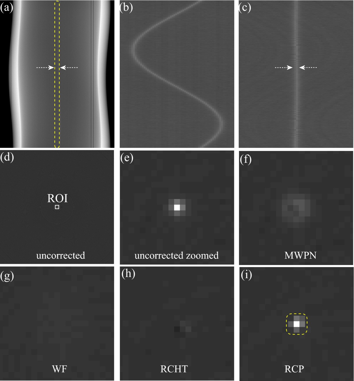 Beam hardening | Radiology Reference Article | Radiopaedia.org