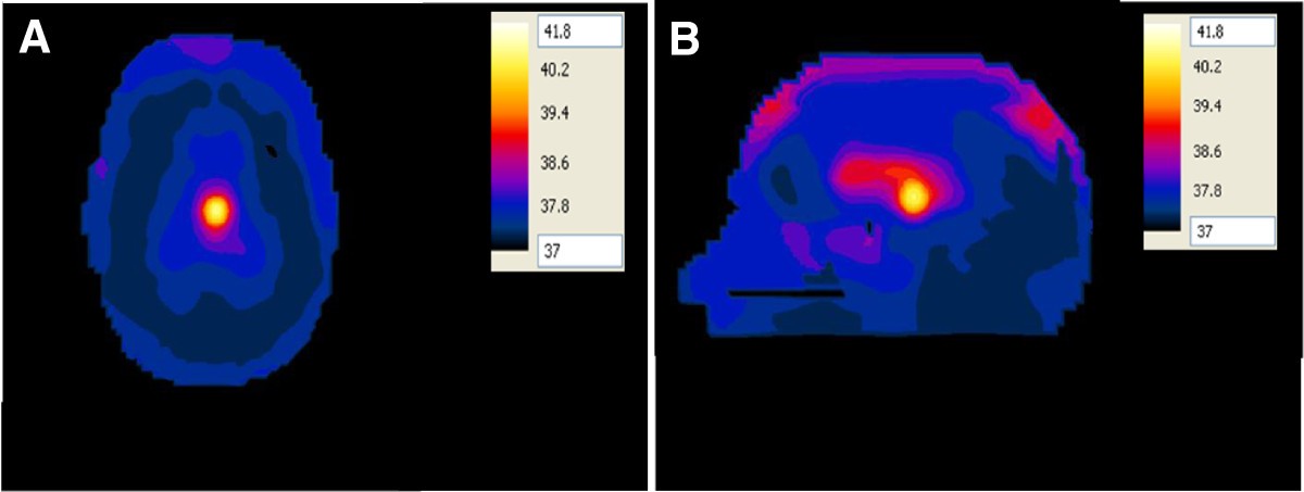 Figure 15