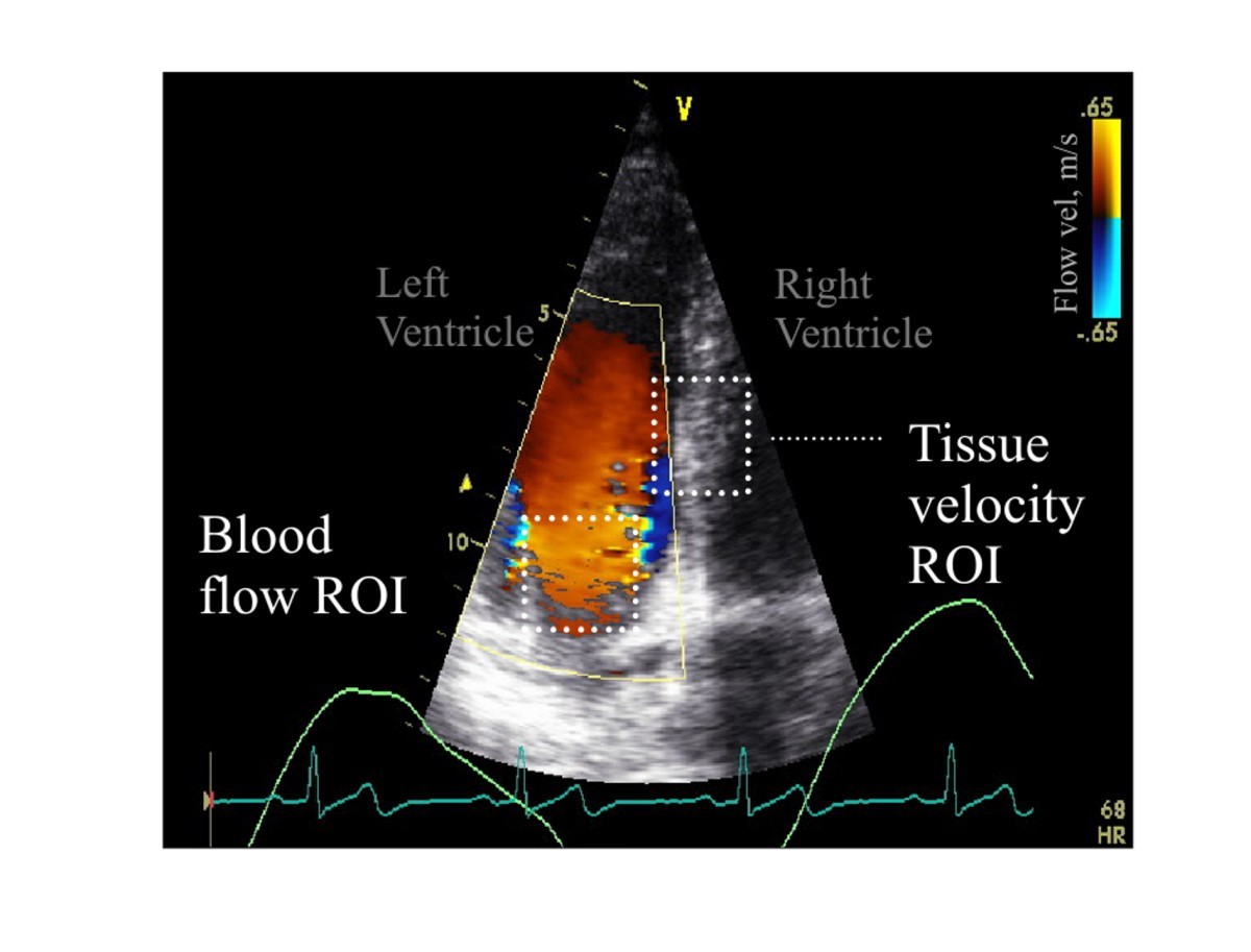 Figure 5