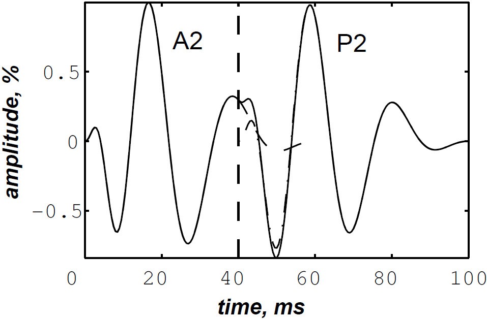 Figure 13